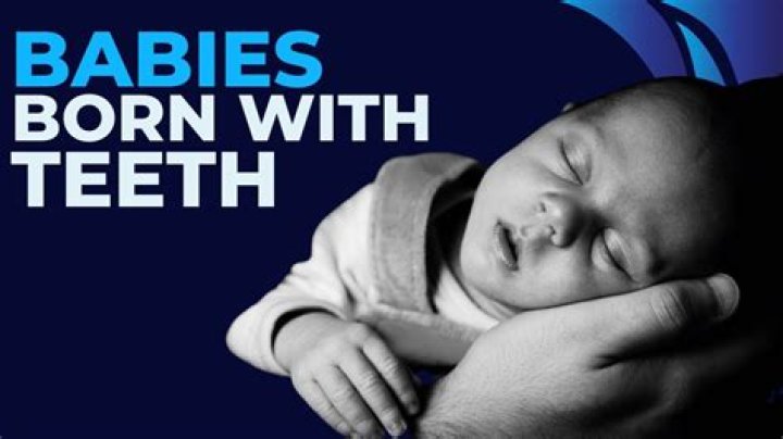Are humans born with teeth