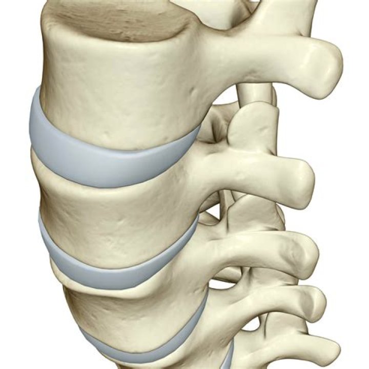 Are spinal discs cartilage