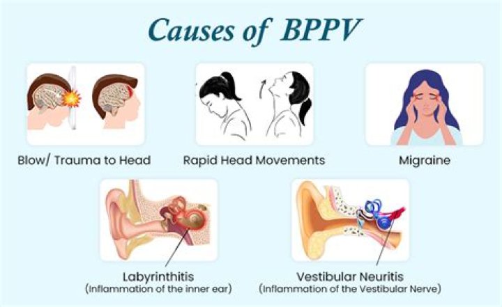 Can Bppv cause ear fullness