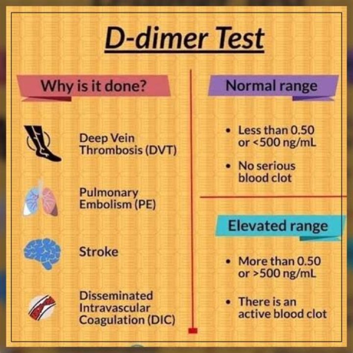Can D-dimer tests be wrong
