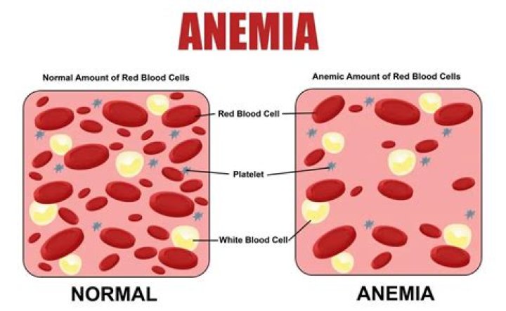 Can elderly die from anemia