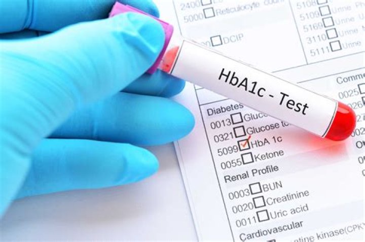 Can I test my HbA1c at home