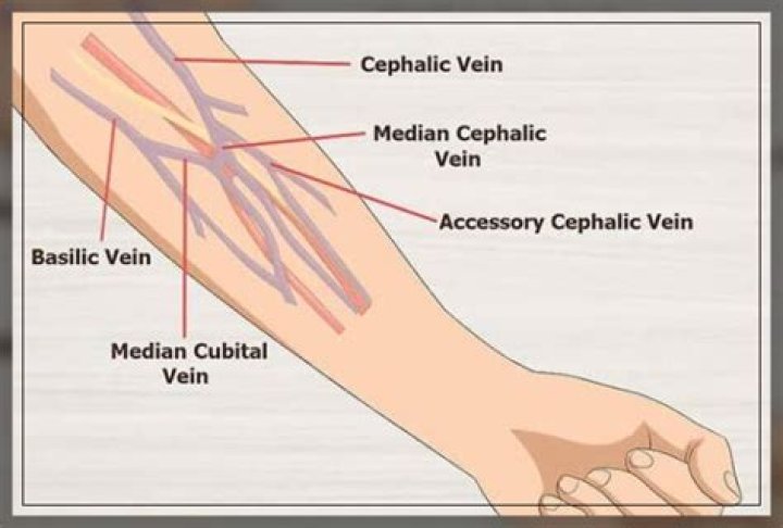 Can LVNs start IVs in Texas