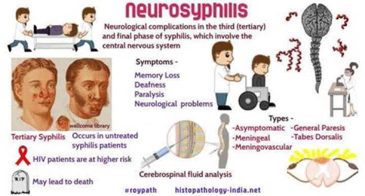 Can syphilis affect nerves