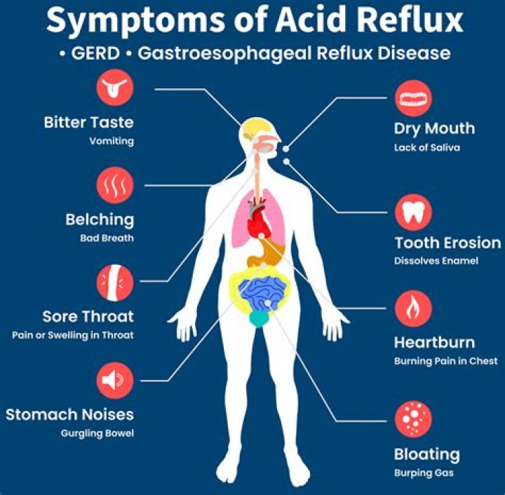 Can virus cause acid reflux