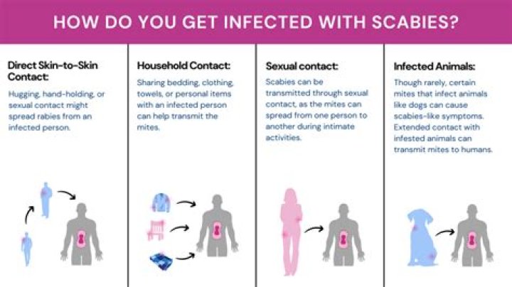 Can you catch scabies from another person