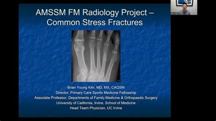 Can you see stress fracture on x ray
