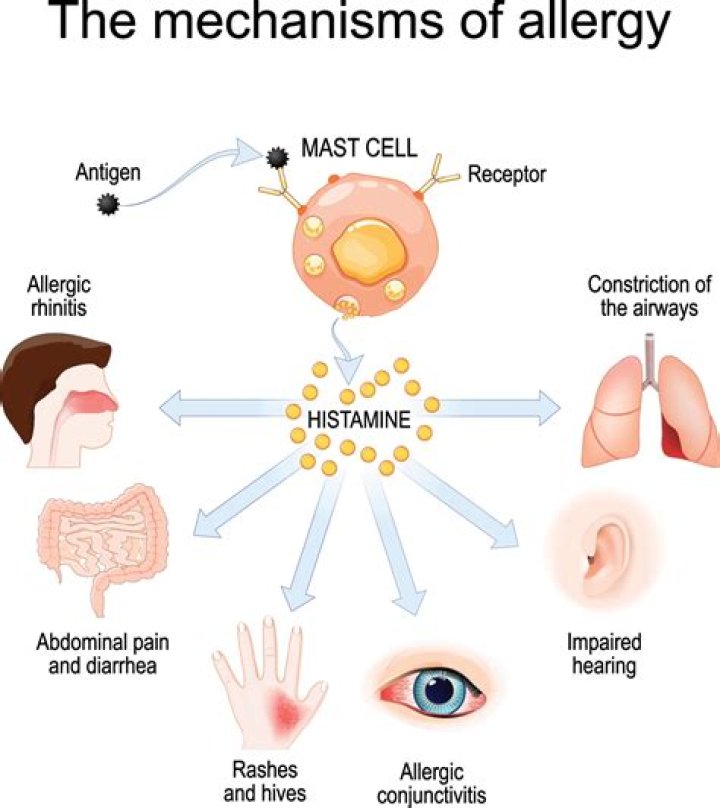 Do allergies cause inflammation in the body