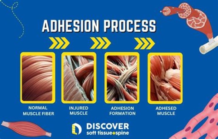 Do muscle adhesions go away