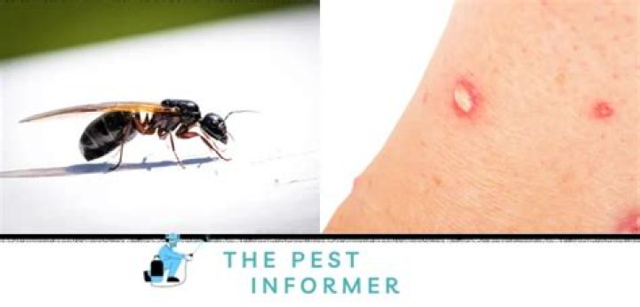 Do regular house ants bite