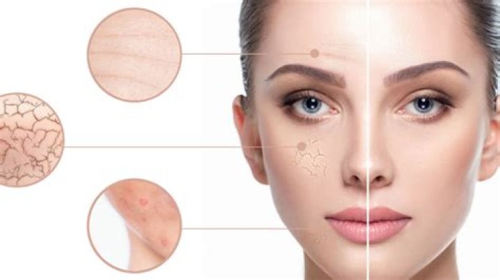 Does red palm oil clog pores