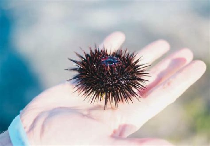 Does urine help sea urchin stings