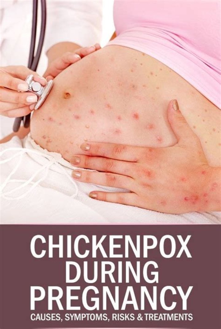 Has anyone had chickenpox while pregnant