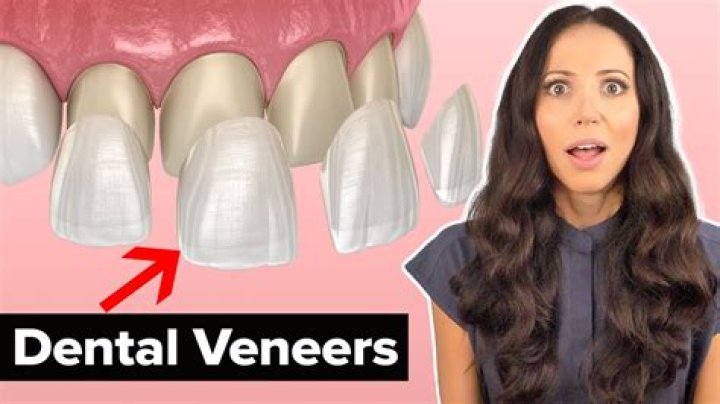 How can I relax my veneers