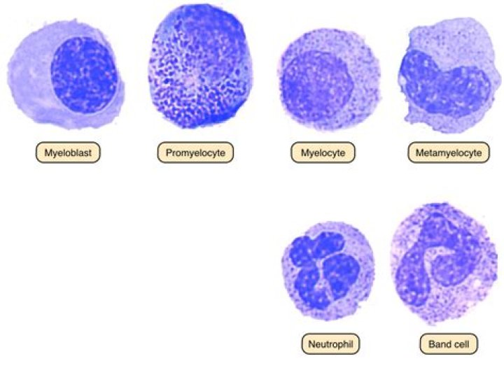 How can you tell the difference between Myeloblast and Erythroblast