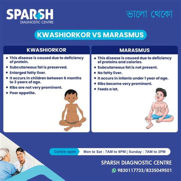 How common is marasmus