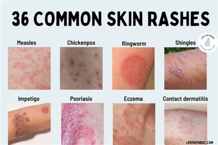 How do you classify a rash