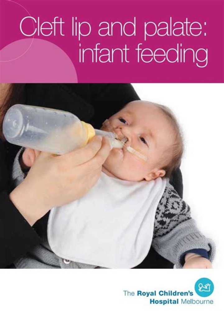 How do you feed a baby with a cleft palate