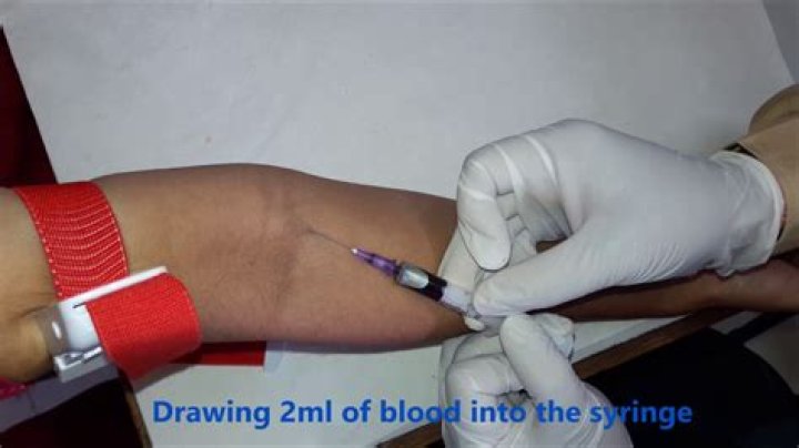 How do you get a venous blood sample