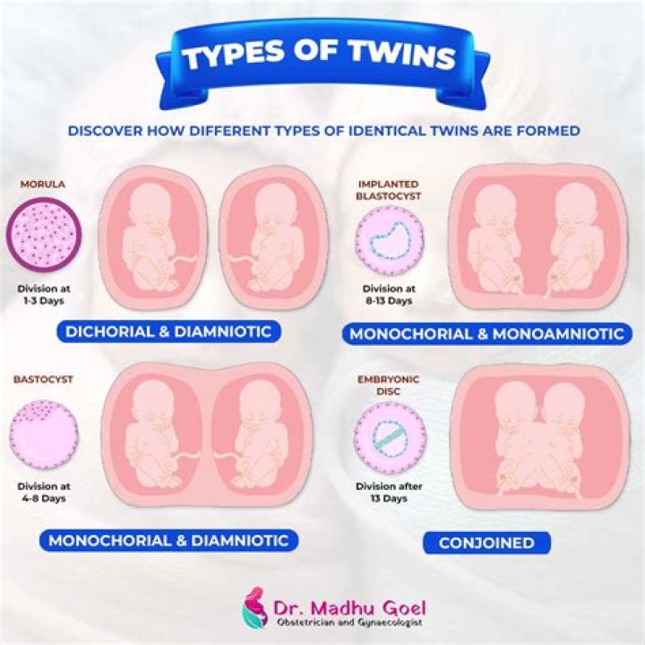 How is multiple pregnancy diagnosed