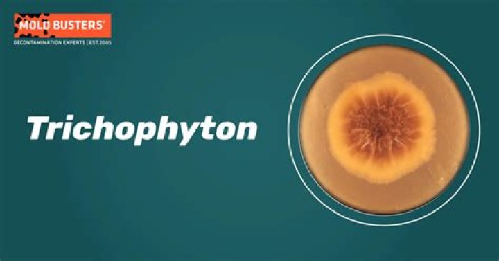 How is Trichophyton treated
