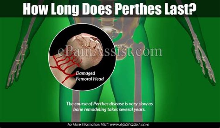 How long does Perthes last