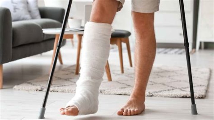 How often do people break their femur