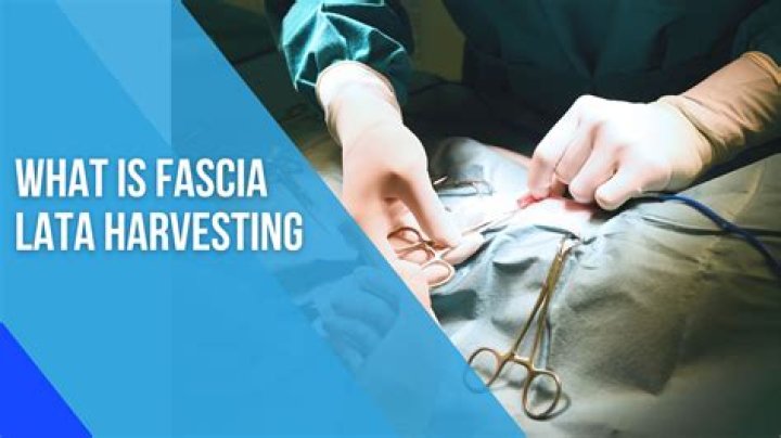 How to harvest fascia lata