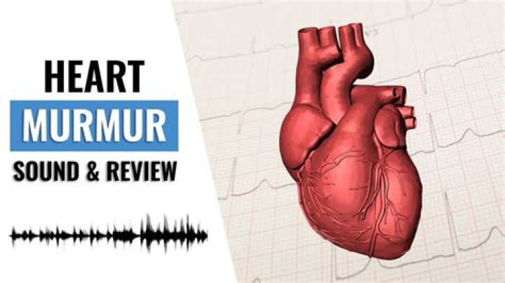 Is a loud heart murmur bad