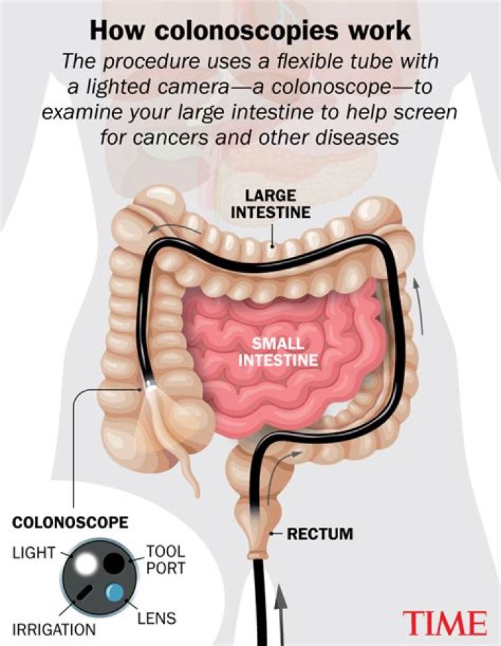 Is a lower GI the same as a colonoscopy