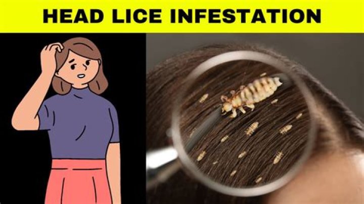 Is having head lice neglect