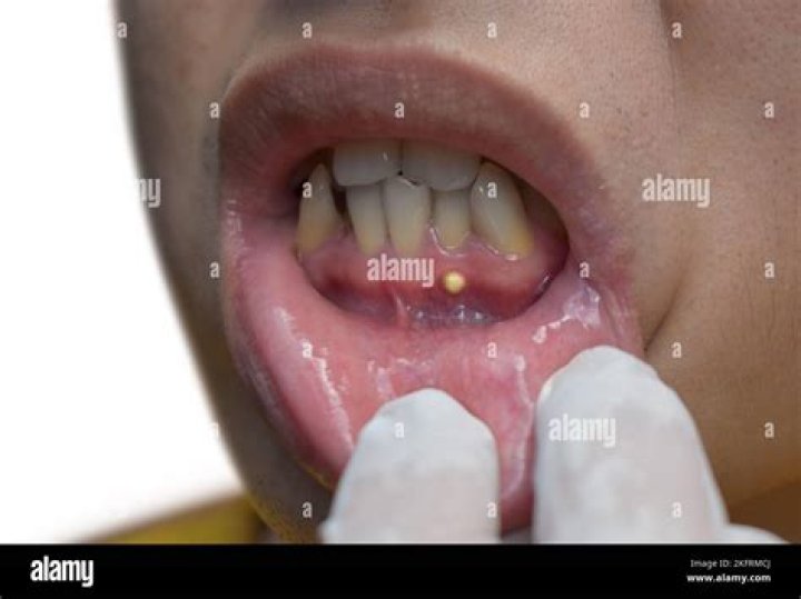Is it bad to eat phosphates