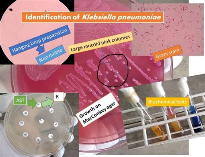Is Klebsiella pneumoniae catalase positive