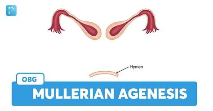 Is Mullerian agenesis rare
