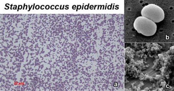 Is Staph epidermidis motile