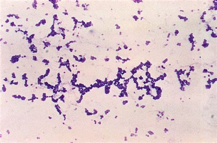 Is Staphylococcus gram positive or negative