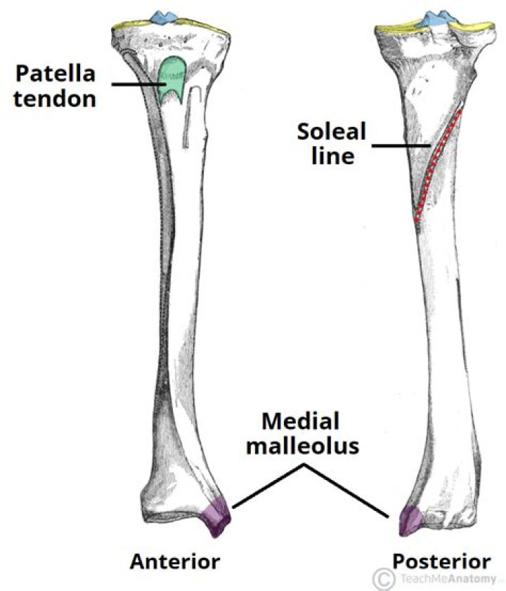 Is the tibia always medial