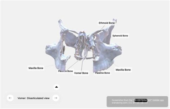 Is the vomer a cranial bone