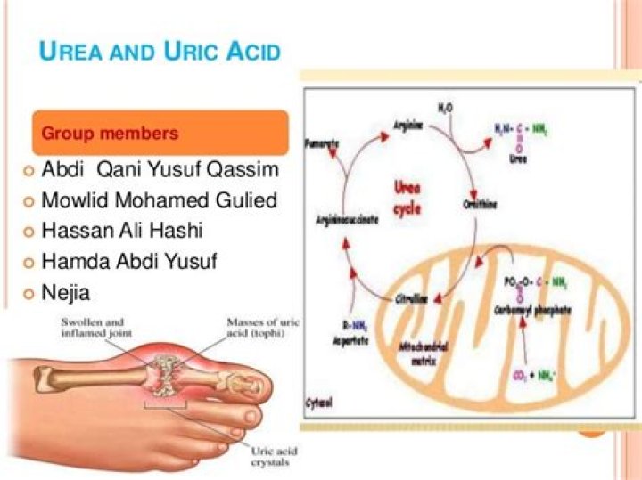 Is urea and uric acid same