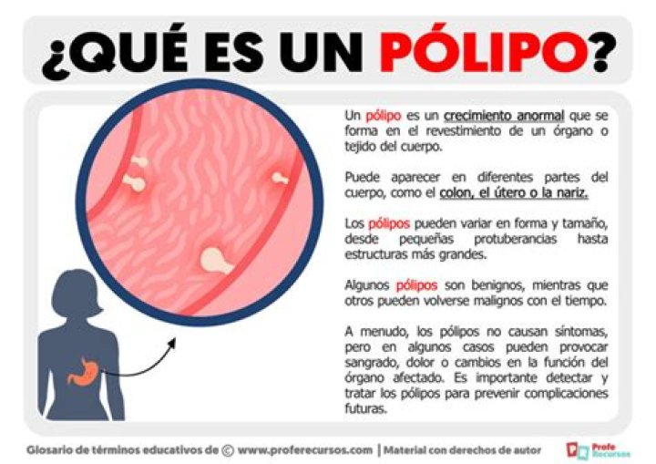 ¿Qué es un pólipo centinela