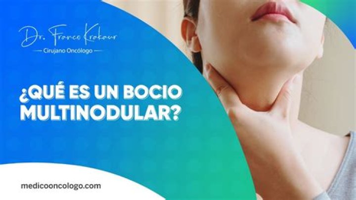 ¿Qué significa multinodular