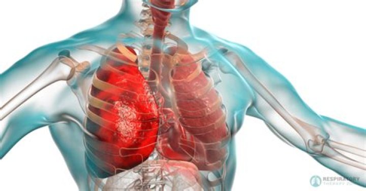 What are cardiopulmonary symptoms