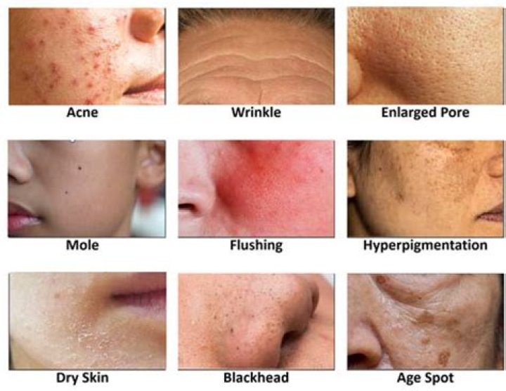 What are some skin conditions