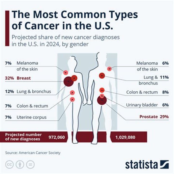 What are the four most common cancers in us