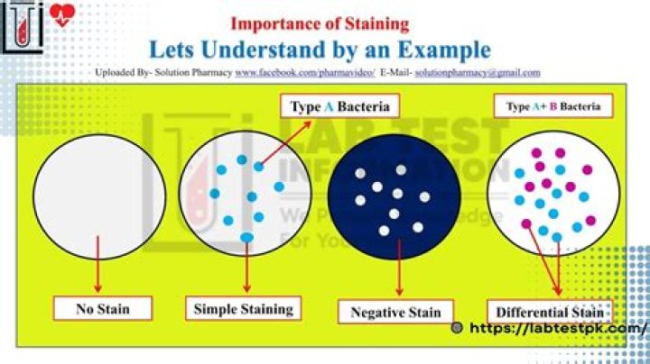 What brand of stain is best