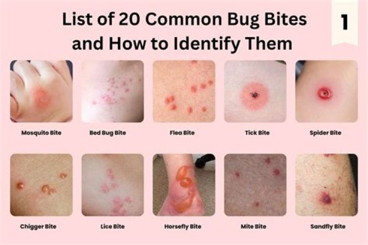 What bugs bite your armpits
