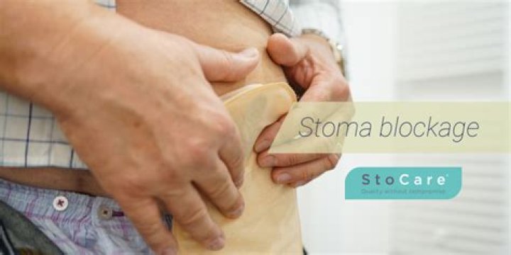 What causes a blocked stoma