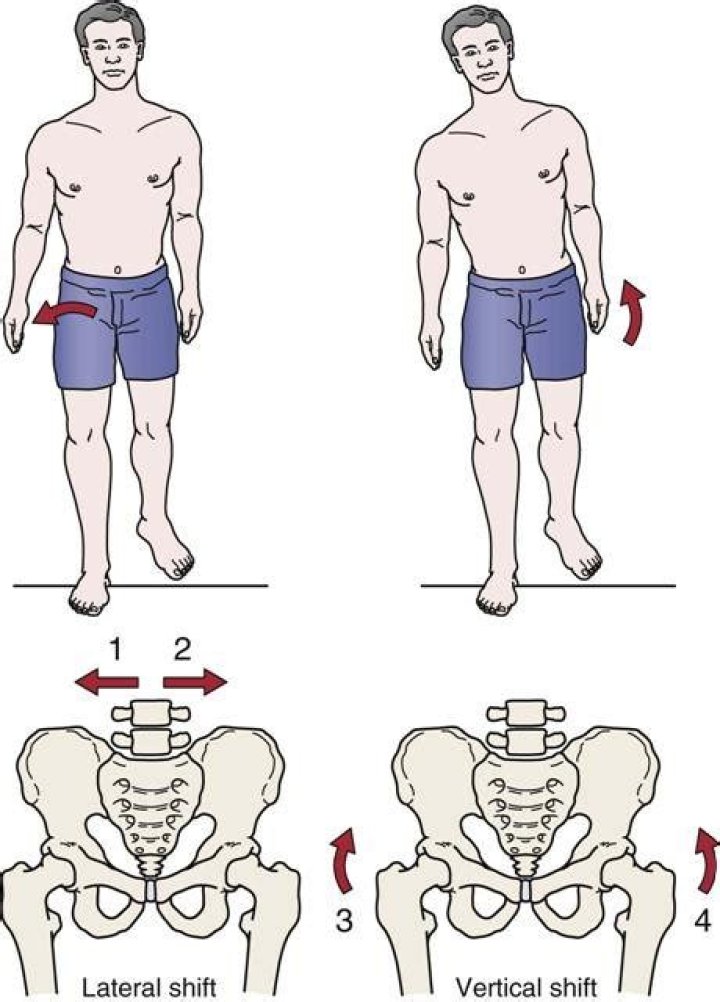 What causes a lateral shift