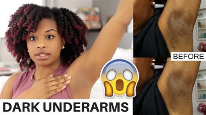 What causes black underarms