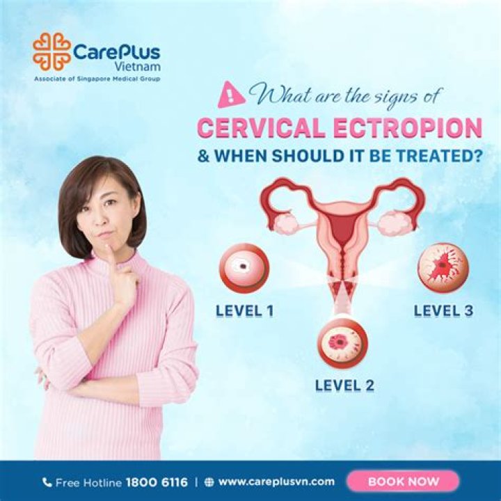 What causes cervical ectropion